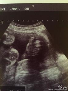 明星 孩子 B超,幸福满满的家庭时刻
